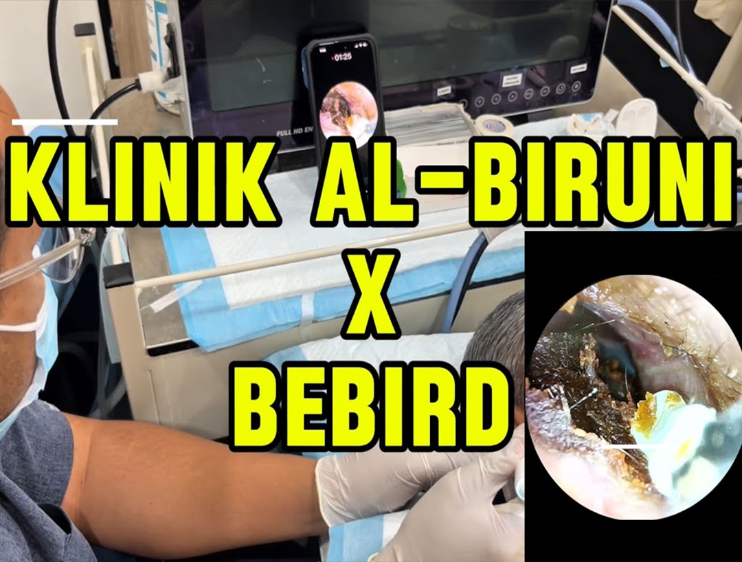 Bebird Official Store