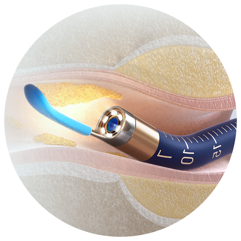 Bebird Official Store